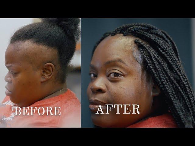 MY CLIENT'S STORY: Transform Your Life With Alopecia Box Braids