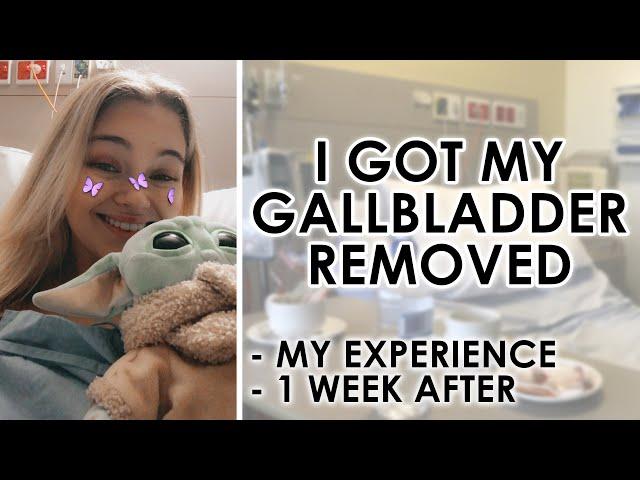 I Got My Gallbladder Removed At 21