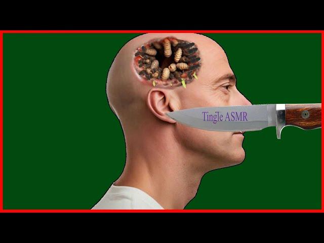 bald man  had treatment animation| ASMR remove maggots from had |ASMR2D treatment animation`