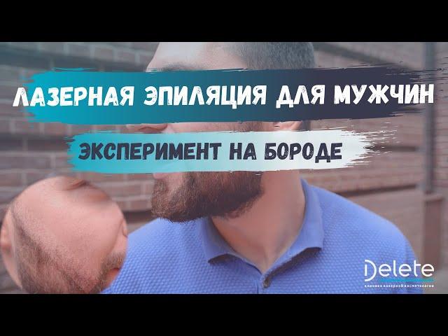 Эксперимент по эпиляции бороды. Результат удивил! | 5 ПРАВИЛ, КОТОРЫХ ДОЛЖЕН ЗНАТЬ КАЖДЫЙ МУЖЧИНА