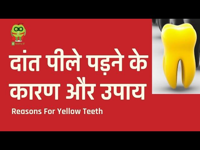 दांत पीले पड़ने के कारण और उपाय | Causes of yellow teeth and solutions | Healthyho