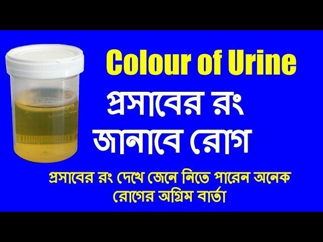 colour of urine | প্রসাবের রং জানাবে রোগ | b2unews | bangla health tips