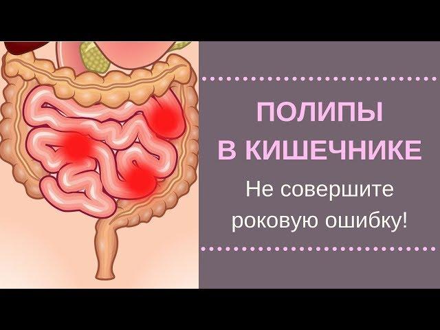 Полипы В Кишечнике. Нашли полипы при колоноскопии. Как не совершить ошибку