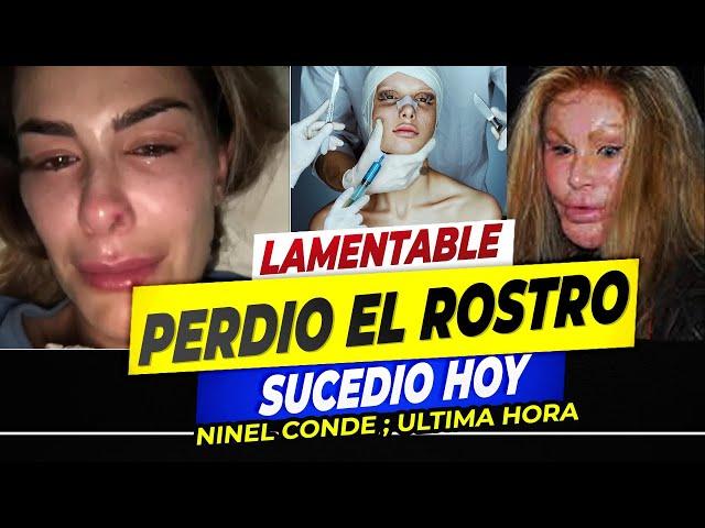 ‼ Ninel Conde REAPARECE con su ROSTRO IRRECONOCIBLE; así quedó tras cirugía