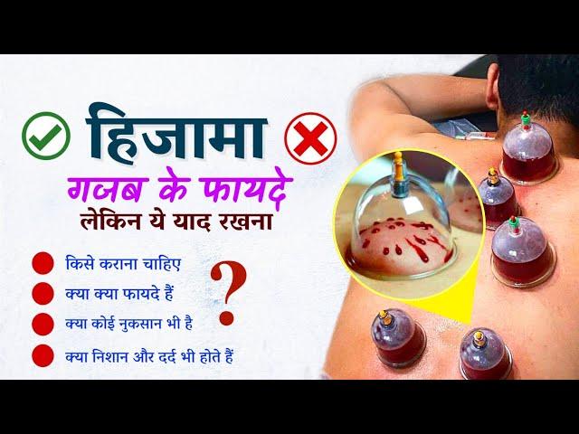 Hijama क्या होता है | कब कैसे और किन लोगों को कराना चाहिए | Hijama (Cupping therapy) ke fayde