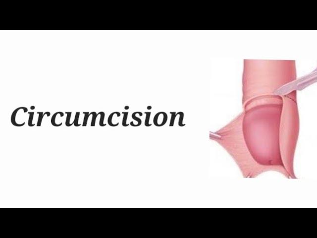 Circumcision surgery