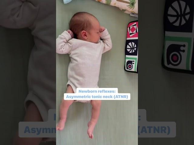 Newborn reflexes. Asymmetric Tonic Neck Reflex (ATNR) Maria Teresa Ferrer, Dr in Physical Therapy