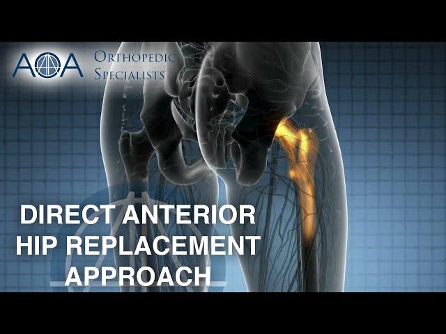 AOA Orthopedic Specialists - Direct Anterior Hip Replacement Approach