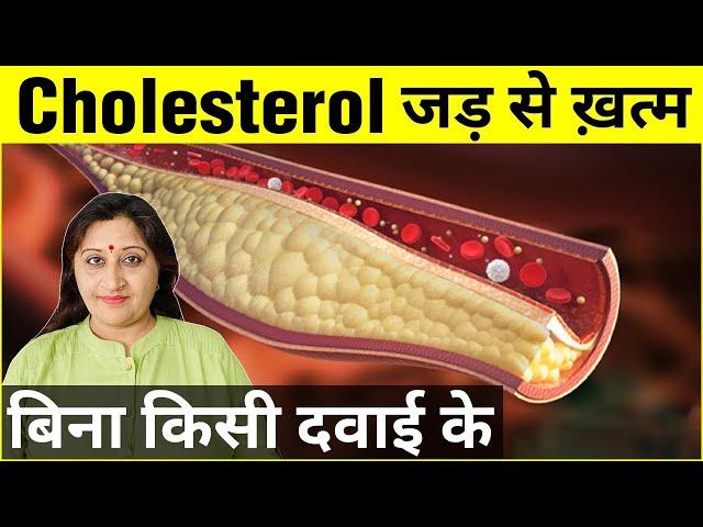 Cholesterol Control Natural Remedies | High Cholesterol Symptoms, Causes, And Acupressure Treatment