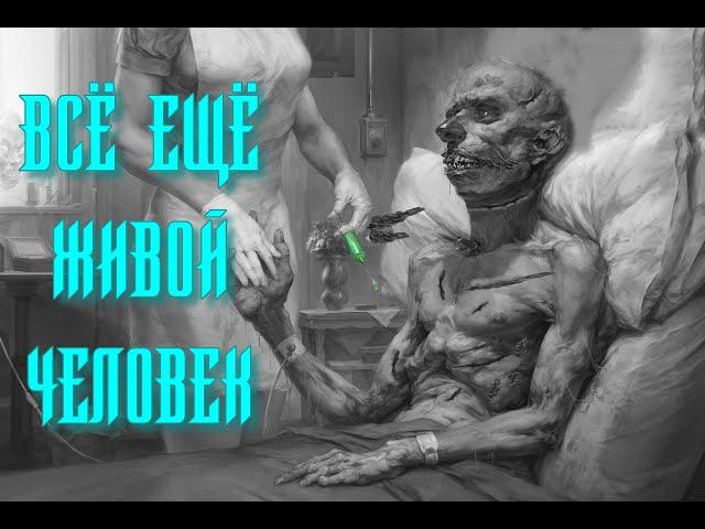 SCP-138 - Всё ещё живой человек