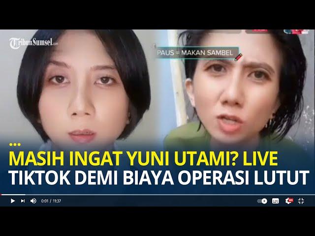 Masih Ingat Yuni Utami ? Eks Polwan Viral, Baru-baru Ini Live TikTok Demi Biaya Operasi Lututnya