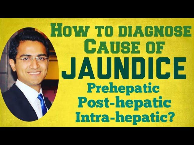 Jaundice Diagnostic Workup - Causes, Symptoms & Treatment