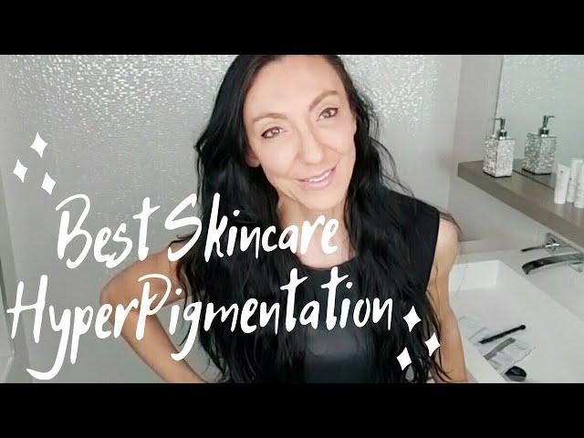 How to Treat Hyperpigmentation | Medical Grade Skincare