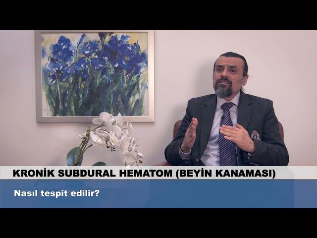 Beyin Kanaması nasıl tespit edilir?