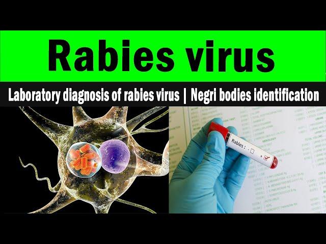 Laboratory diagnosis of rabies virus | Negri bodies identification