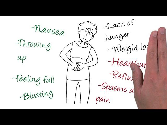 Understanding diabetic gastroparesis