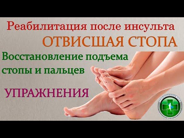 Отвисшая стопа. Восстановление подъема стопы. Упражнения.