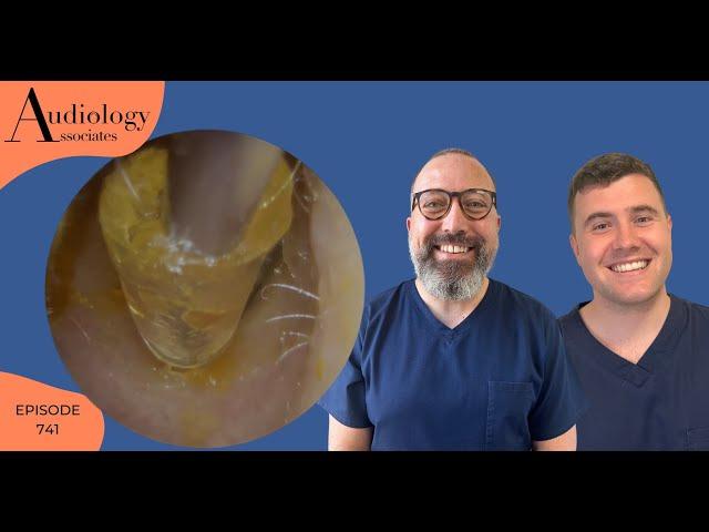 MYSTERY OBJECT REMOVAL FROM A PATIENTS EAR - EP741