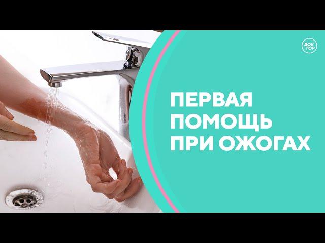 Первая помощь при ожогах. Скажите, доктор!