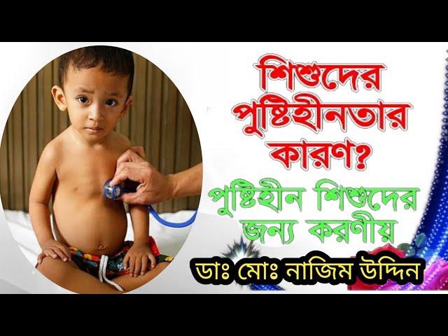 শিশুদের পুষ্টিহীনতার কারণ? পুষ্টিহীন শিশুদের জন্য করণীয়।। ডাঃ মোঃ নাজিম উদ্দিন