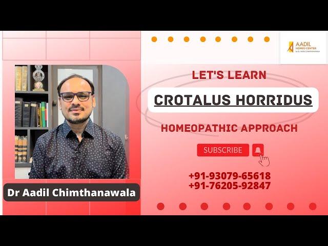 CROTALUS HORRIDUS। Homeopathic remedy। Dr Aadil Chimthanawala #youtube #video #health #cure