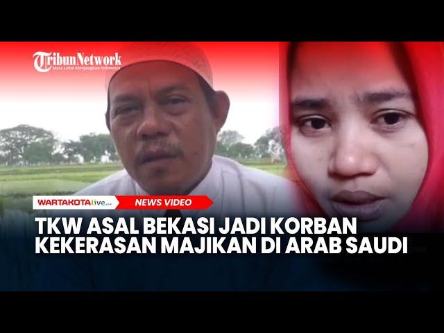 Niat Ingin Dapat Gaji Besar, TKW Asal Bekasi Jadi Korban Kekerasan Majikan di Arab Saudi