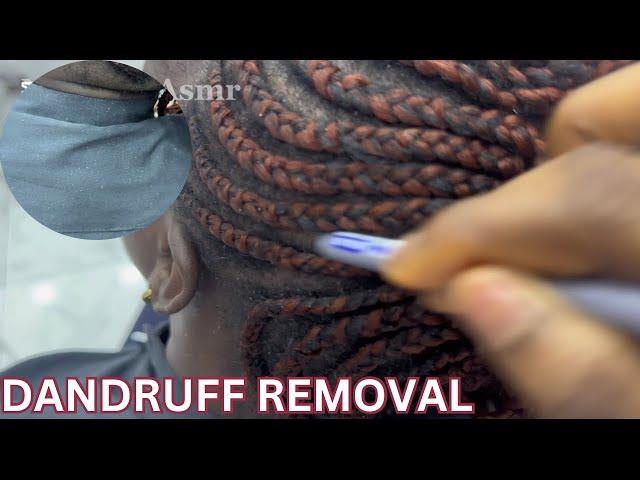 ASMR: RAW DANDRUFF REMOVAL & SCALP CHECK ON COLLEAGUE’S HEAD AT THE OFFICE/ NO MIC (office tools)