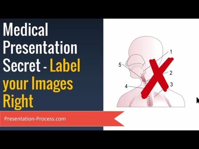 Medical Presentation Secrets  : Label Images Right