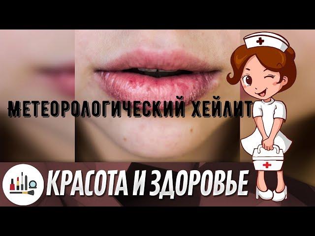 Метеорологический хейлит