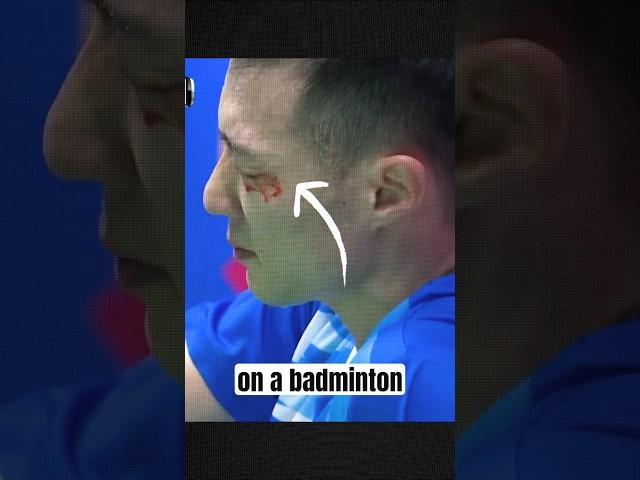 A Rare Accident in Badminton #youtube #youtubeshorts #shorts #badminton