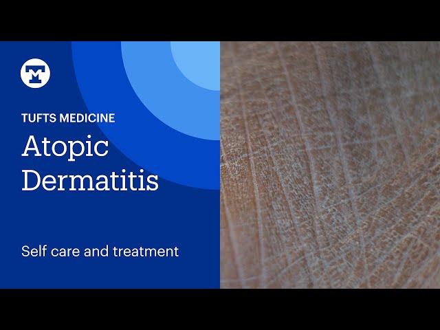 Atopic Dermatitis: Self Care and Treatment | Tufts Medicine