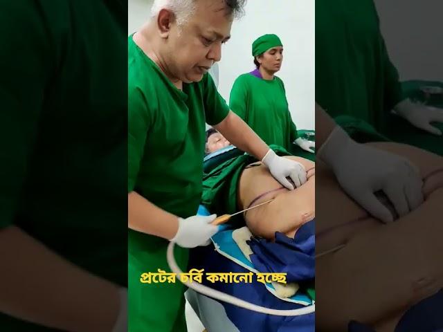 পেটের চর্বি কমানোর উপায় || Lower belly Fat Removing || Liposuction| ️01639139232 What’s App & imo