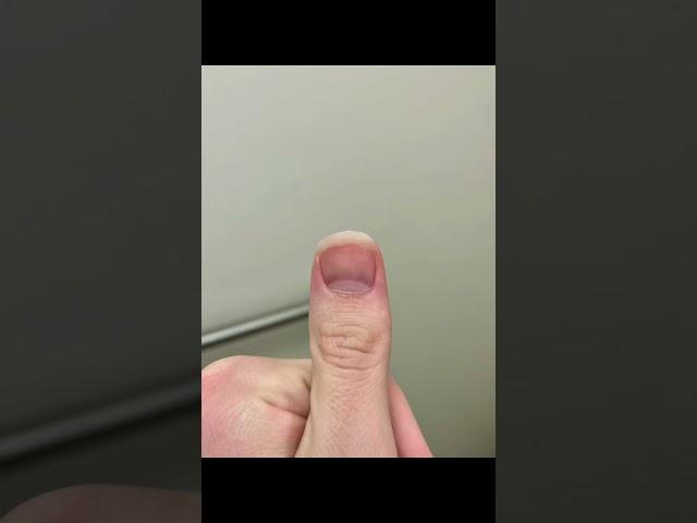 Time lapse- Fingernail Growth (4 months)