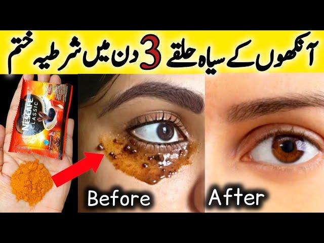 How To Remove Dark Circles in 3 Days || Dark Circles treatment || Glam Tips By Amna