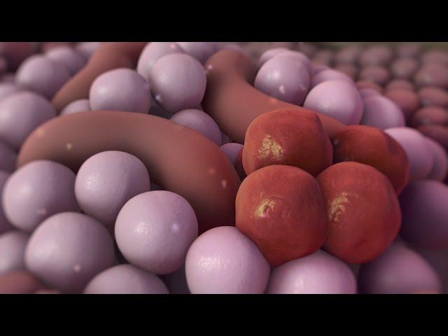 Pancreatic Cancer | Nucleus Health