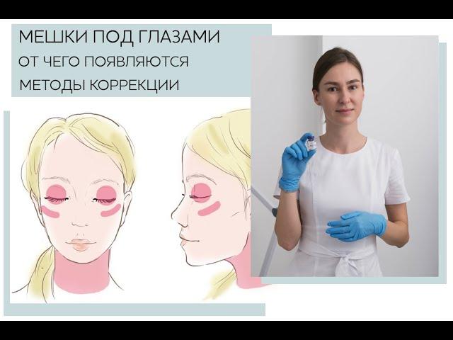 Все про малярные мешки с Марией Носулич: физиология, причины, коррекция