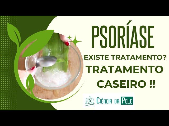 EXISTE TRATAMENTO CASEIRO PARA PSORÍASE? [SAIBA! ]