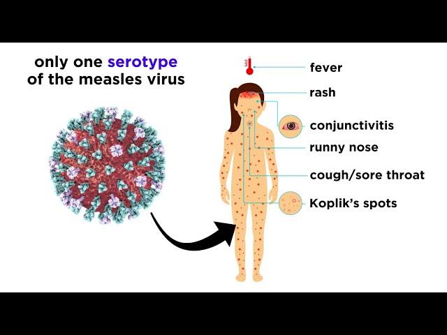 Measles (Genus Morbillivirus)