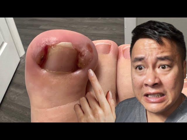 WHAT'S THAT COMING OUT OF THE TOE??