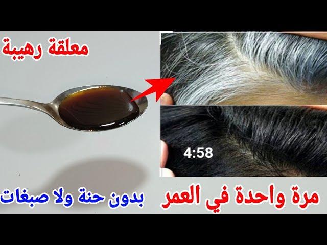 معلقة رهيبة تخلصك من شيب الشعر بسرعة الصاروخ بدون حنة ولا صبغة،عمرى ما تخيلت يكون مفعولها سريع كده