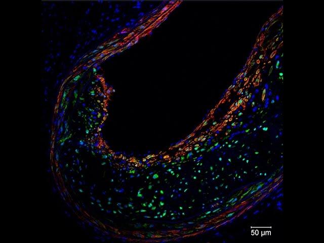 Potential ‘Fountain of Youth’ Gene May Offer Way to Block Detrimental Effects of Aging