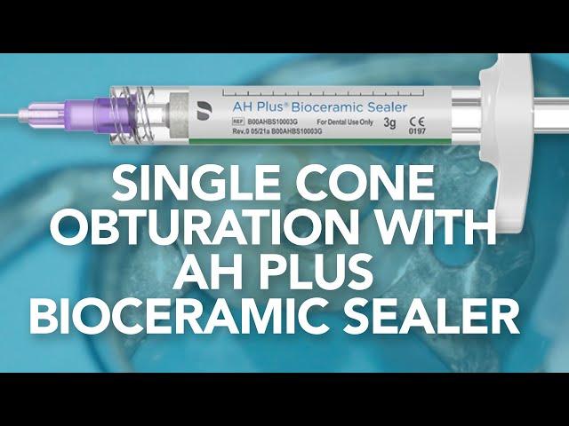 Obturation with AH Plus Bioceramic Sealer