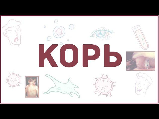 Корь - причины, симптомы, диагностика, лечение