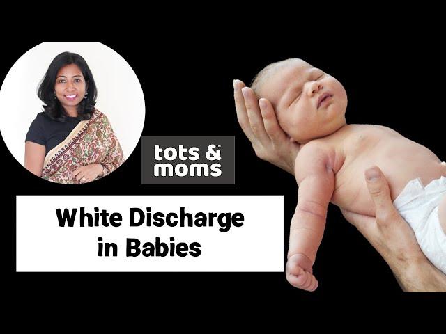 White Discharge in Newborn Babies | Causes, Care, and When to meet doctor