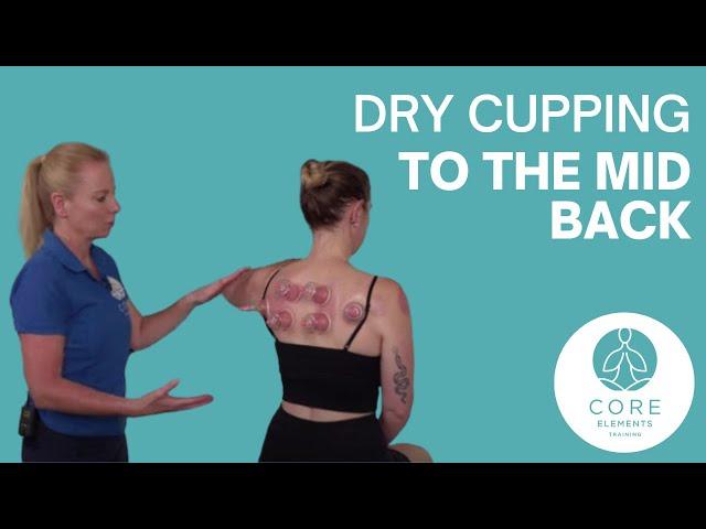 Dry Cupping to the Mid Back - #drycupping and #functionalmovement