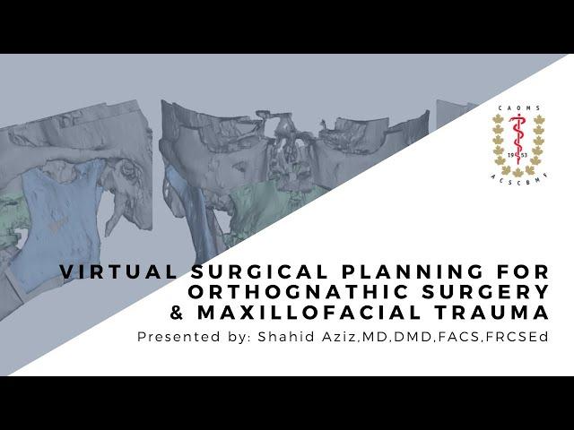 Virtual Surgical Planning for Orthognathic Surgery & Maxillofacial Trauma