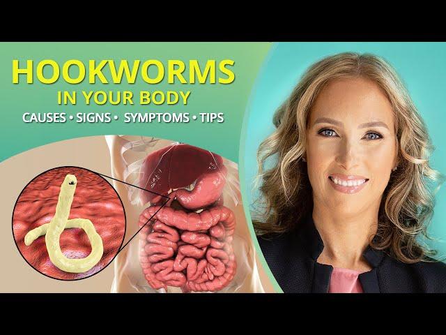 Hookworms | Causes, Signs, Symptoms, & Tips #parasites | Dr. J9 Live