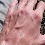 veiny hand