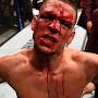 Nate Diaz