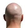 Bald Guy